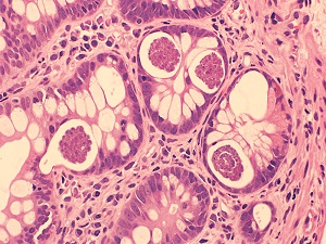 Case470_A parasitic image