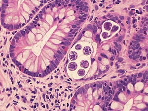 Case470_B parasitic image