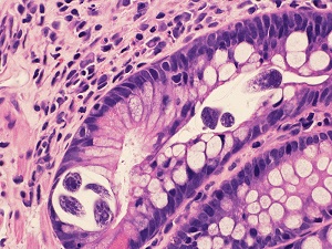 Case470_C parasitic image