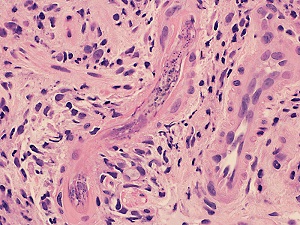Case470_D parasitic image