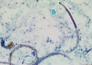 Case470_G parasitic image