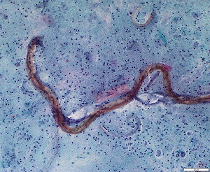 Case470_H parasitic image