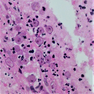 Case471_B parasitic image