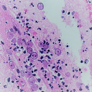 Case471_C parasitic image