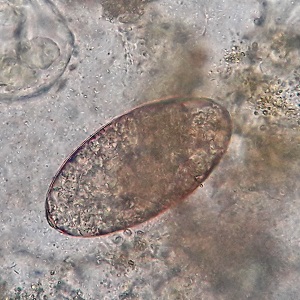Case472_D parasitic image