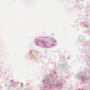 Case475_A parasitic image