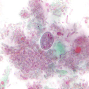 Case475_B parasitic image
