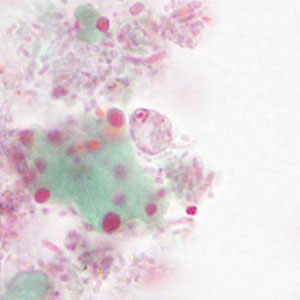 Case475_C parasitic image