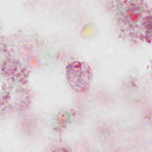 Case475_D parasitic image