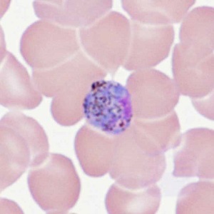 Case478_A parasitic image