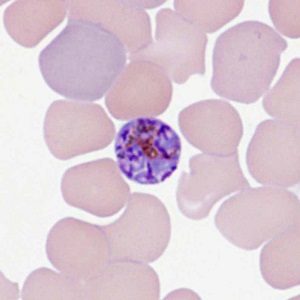 Case478_E parasitic image