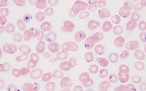 NOVEMBER - 2018 - CASE #480 parasitic image