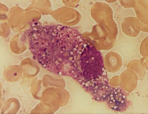 Case481_B Parasitic Image