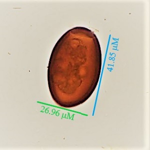 Case482_A Parasitic Image