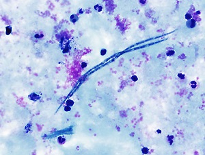 Case_474_A parasitic image