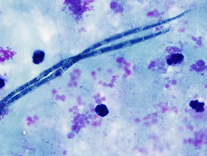 Case_474_B parasitic image