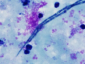 Case_474_C parasitic image