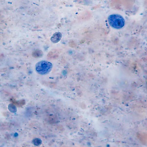 JANUARY - 2019 - CASE #483 parasitic image