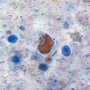 Case483_B parasitic image