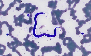 Case484_A parasitic image