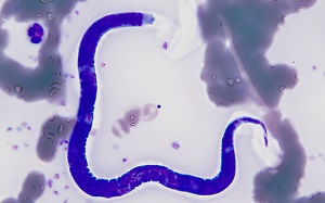 Case484_B parasitic image