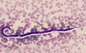 Case484_C parasitic image