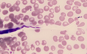 Case484_E parasitic image