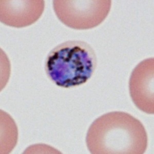 Case485_D Parasitic image