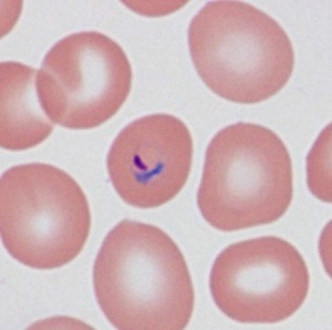 Case485_F Parasitic image