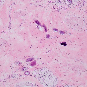 MARCH - 2019 - CASE #487 parasitic image