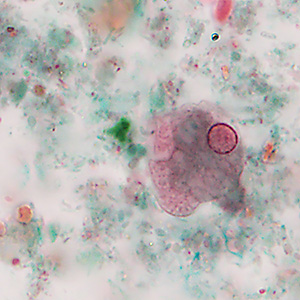 MARCH - 2019 - CASE #488 parasitic image