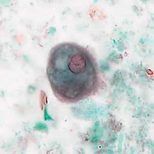 Case488_B parasitic image