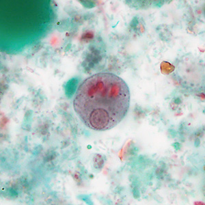 Case488_C parasitic image