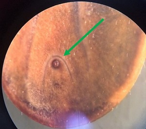 Case490_E Answer Figure E
