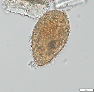 JULY - 2019 - CASE #496 parasitic image