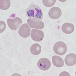 SEPTEMBER - 2019 - CASE #499 parasitic image