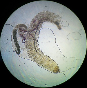 SEPTEMBER - 2019 - CASE #500 parasitic image