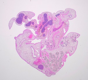 OCTOBER - 2019 - CASE #501 parasitic image