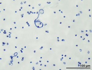 OCTOBER - 2019 - CASE #502 parasitic image