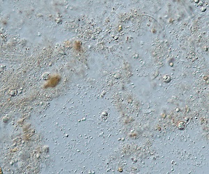 DECEMBER - 2019 - CASE #506 parasitic image