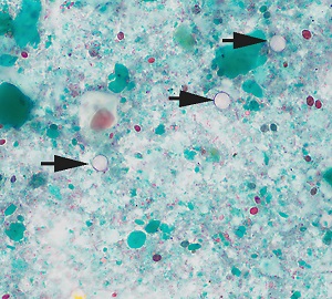 Case506_C_Answer Figure