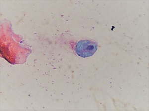 MARCH - 2020 - CASE #512 parasitic image