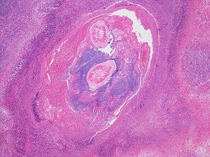 MARCH - 2020 - CASE #511 parasitic image