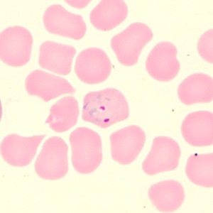 Case_515_C Case_515_C