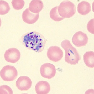 Case_515_F Case_515_F