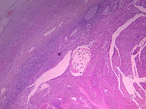 JUNE - 2020 - CASE #517 parasitic image