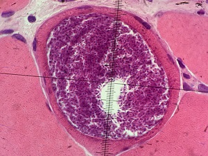 JULY - 2020 - CASE #519 parasitic image