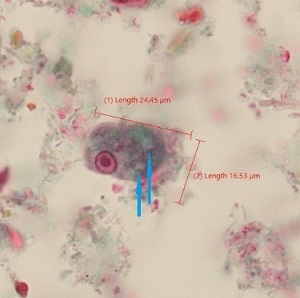 Case_520_A_Answer Case_520_answer