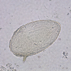 schistosoma mansoni eggs