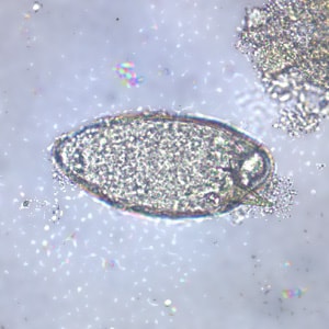 schistosoma mansoni